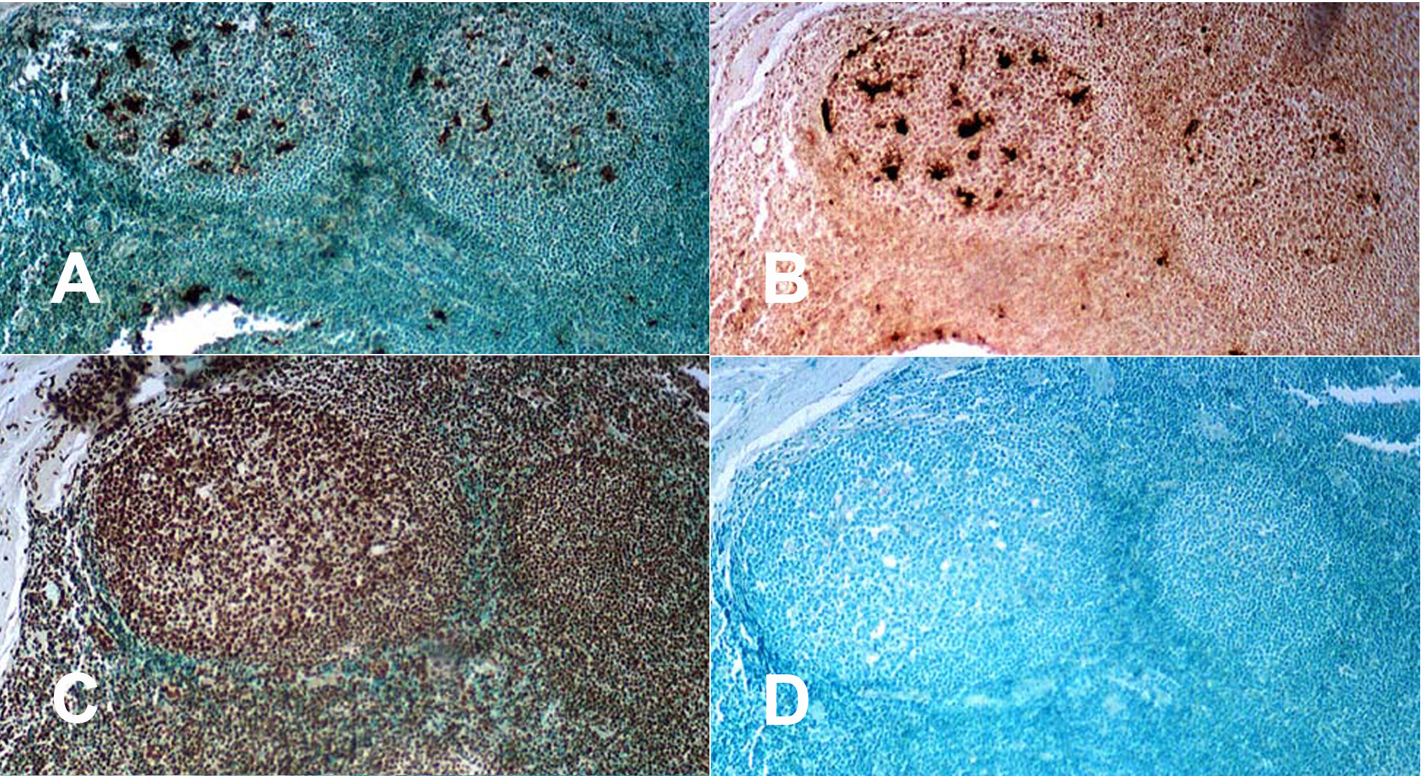 Figure 2. DNA Fragmentation Detection Kit (X2044K) using paraffin fixed human tonsil tissue, 10 μm sections (1000X). [A] Section processed and counter-stained with methyl green according to the DNA Fragmentation Detection Kit manual. [B] Counter-stain step was eliminated to more clearly illustrate the level of positive staining in the germinal centers of tonsil tissue. [C] Section treated with DNase I in order to generate a positive control slide. Note all nuclei stain positive. The use of DNase I generates free 3’-OH groups on cellular DNA, these free 3’-OH groups are then labeled with biotin-nucleotide by the TdT in the DNA Fragmentation Detection Kit (X2044K). [D] Negative control, where the TdT enzyme step was eliminated, thereby generating a negative slide.